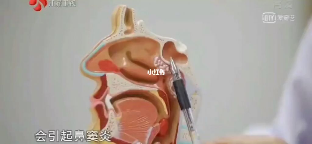 鼻粘膜在哪里(眼口鼻粘膜部位)