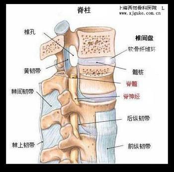 腰间盘突出症的判断(腰椎l4l5突出硬膜囊受压)