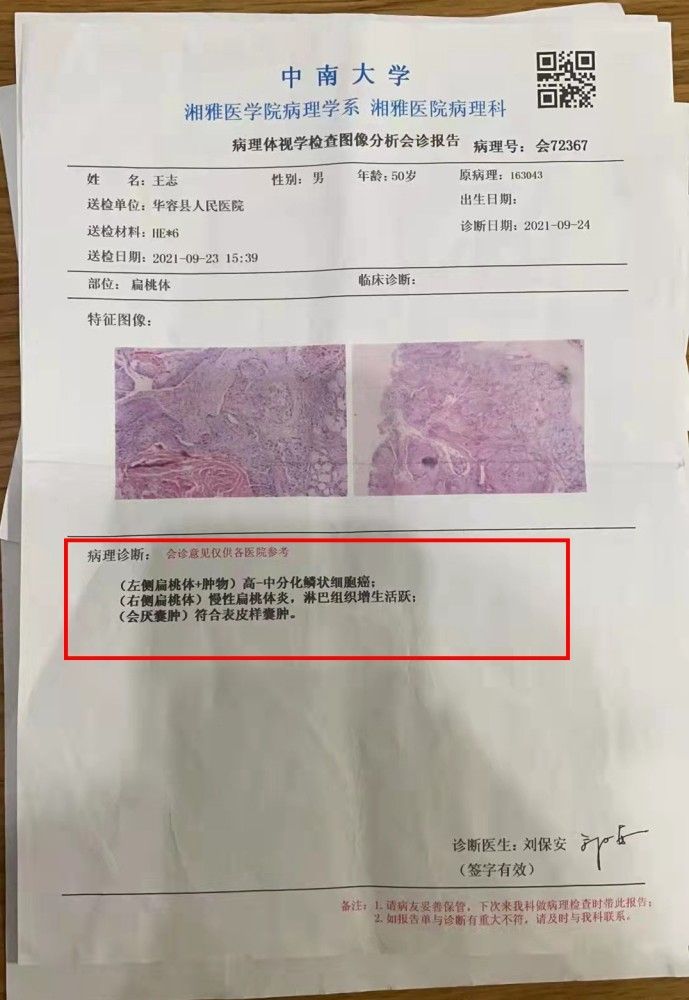 扁桃体就诊单(扁桃体发炎病例)