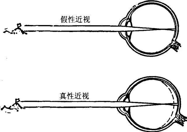 阴轴在哪里(男人长度标准对照表)