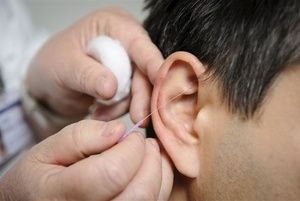 关于脂溢性皮炎为什么可以用激素的信息