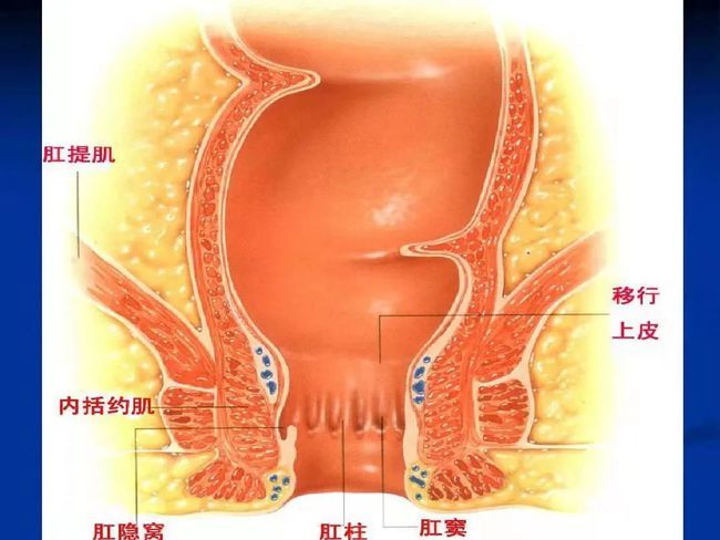 关于痔疮手术后反复发炎怎么办的信息