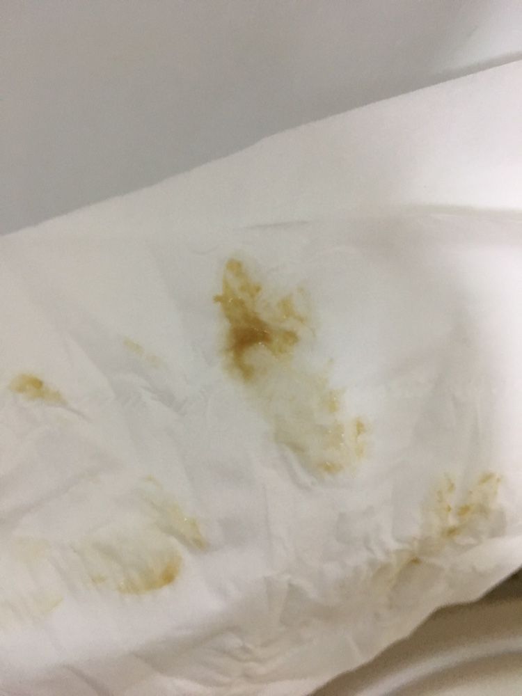 内阴有点瘙痒怎么办(内阴瘙痒好像长了东西)