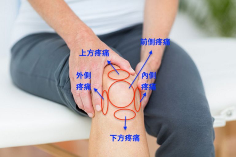 包含跑步后膝盖内疼了一周了不红不肿的词条