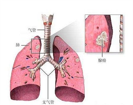 气管在哪儿(气管在哪儿切)