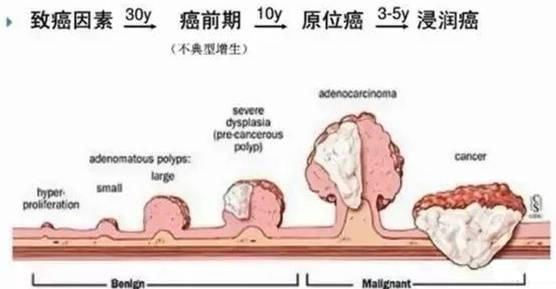 关于内痔会不会有黏膜样的东西脱落的信息