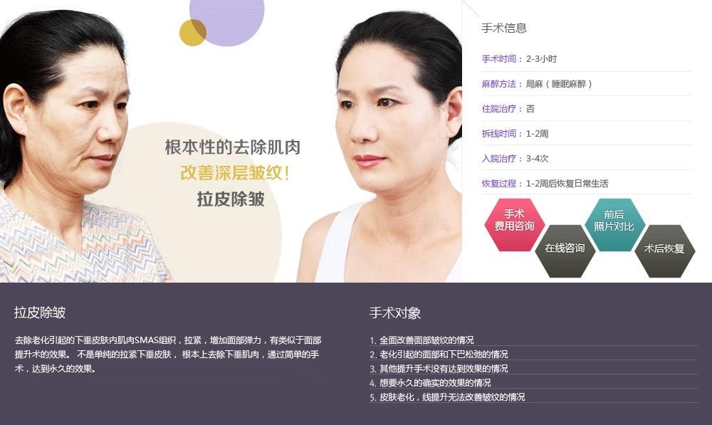 拉皮手术辽阳(面部拉皮手术多少钱)