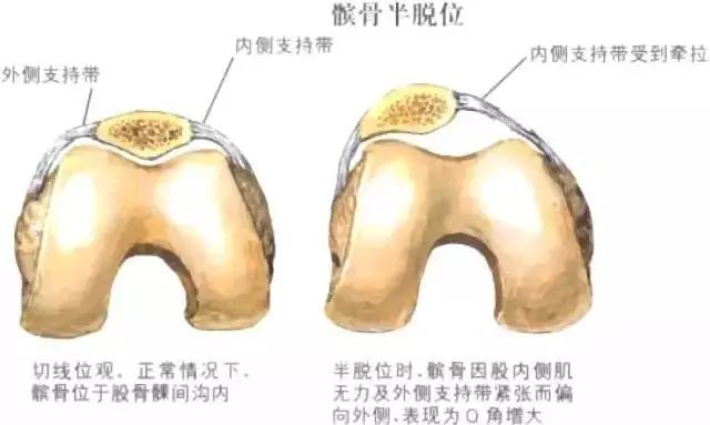 关于宾骨在哪里的信息