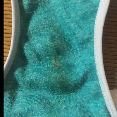 包含孕7个月内裤上有褐色的印记的词条