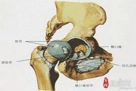 包含20几岁骨头坏死二期能治好吗的词条