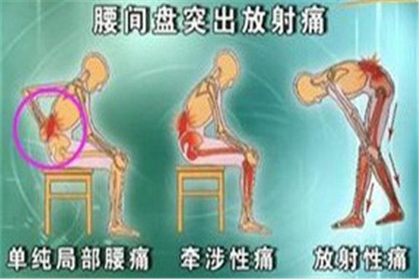 腿间在哪(腿间在哪里)