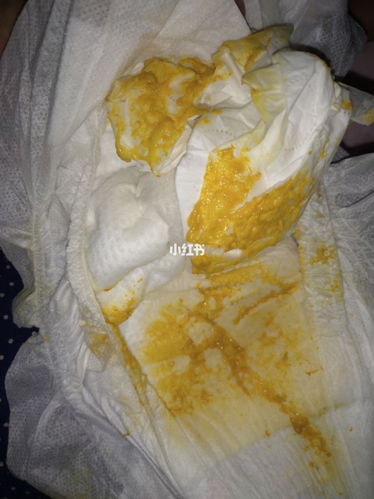 肚子一阵绞痛拉稀吃什么(拉稀肚子一阵一阵绞痛要怎么做)