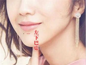 女生痣长在哪里好看(长得好看的人痣长在哪里)