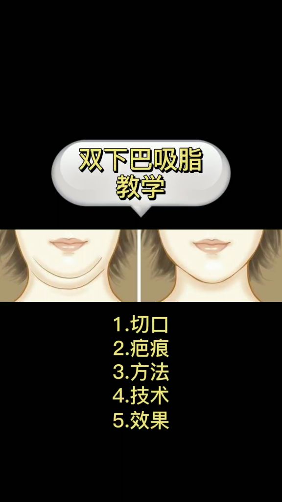 八分在哪里(顶点八分公司在哪里)