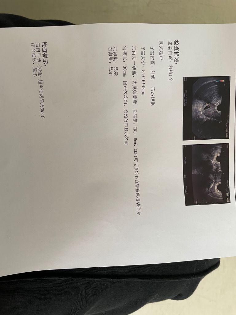 囊胚移植最晚几周可以看到胎心的简单介绍