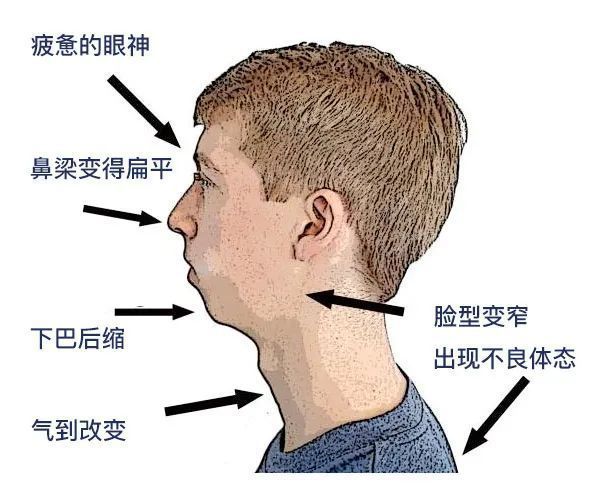 上颌在哪个位置图(右上颌在什么位置图)