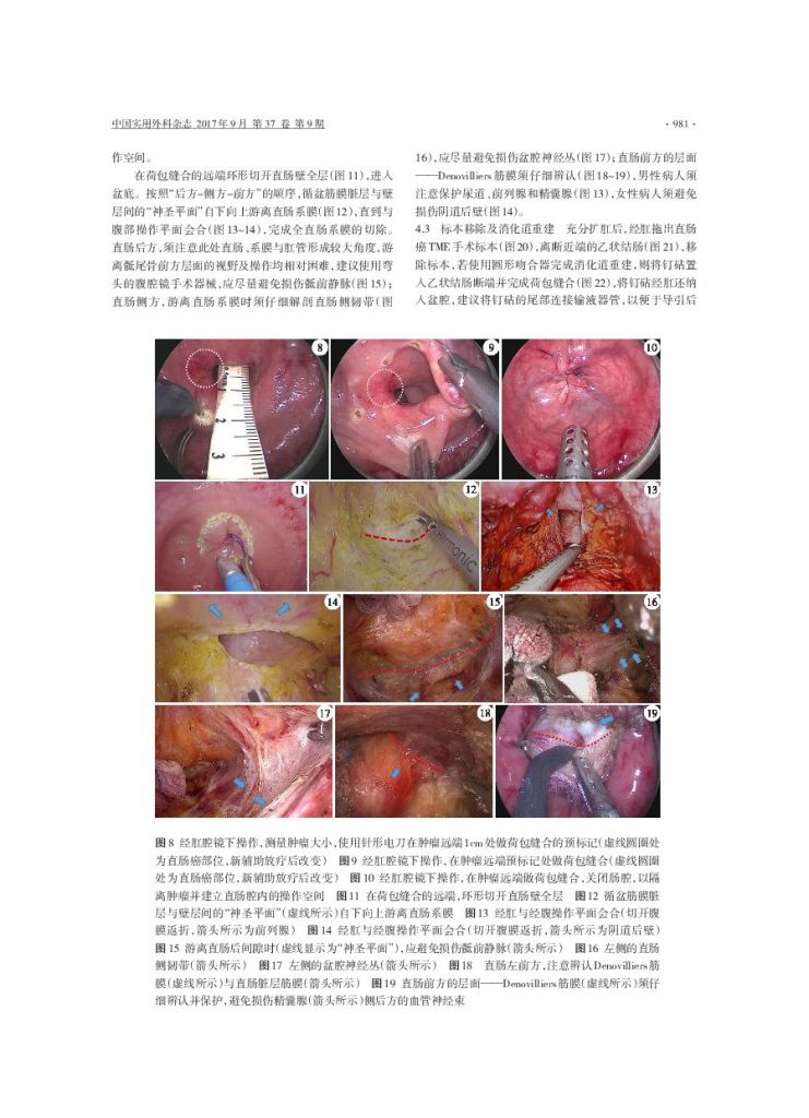 肛膜在哪里(括约肌松弛锻炼方法)