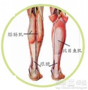 跟腱炎在哪(跟腱炎的锻炼治疗方法)