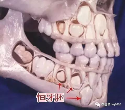 恒牙在哪个位置(恒牙是哪几颗图片)