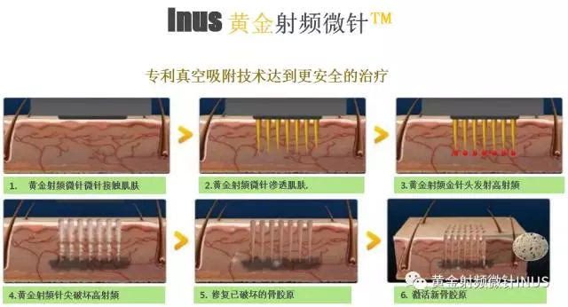 细微效果在哪里(表格细微效果在哪里)