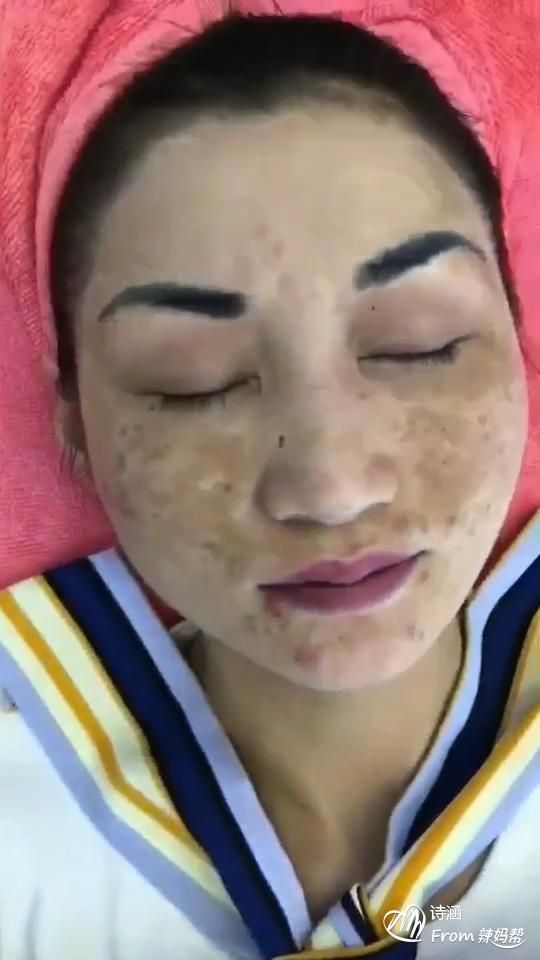 祛斑霜用在哪个步骤(秋冬护肤品的正确使用顺序)