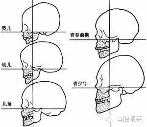面颅在哪里(颅面畸形图片)