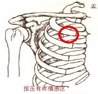 肩胛骨缝在哪(肩胛骨缝在哪个位置图片)