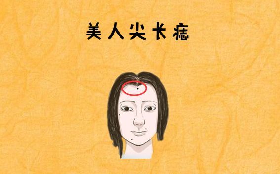 苦穷痣在哪里(苦痣长在哪里图解)