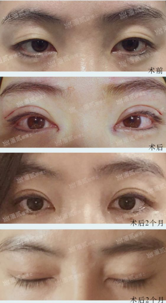 双额在哪(双额在哪儿)