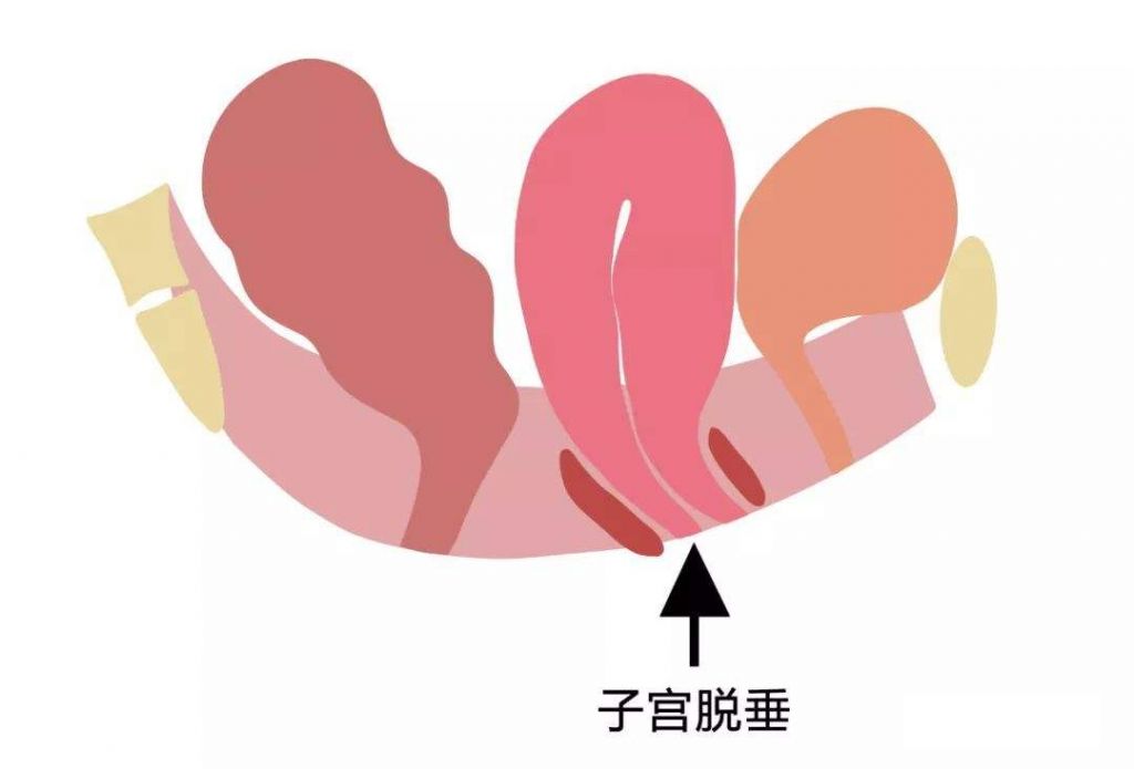 关于女生下面的阴道在哪的信息