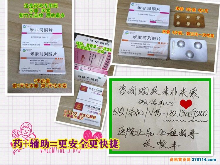 打胎药在哪里可以买到(打胎药在哪里可以买到导航)