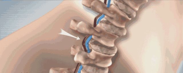 瓦棘在哪里(挖机在什么价位)
