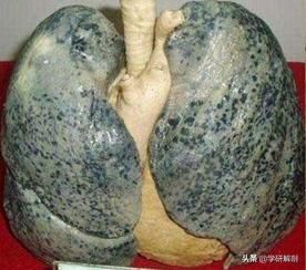 肺部在哪(肺部在哪个位置)