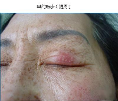痒嘴唇在哪(嘴唇又干又痒怎么办)