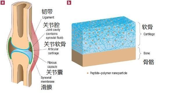 关节软骨在哪(关节软骨过度磨损怎么缓解疼痛)