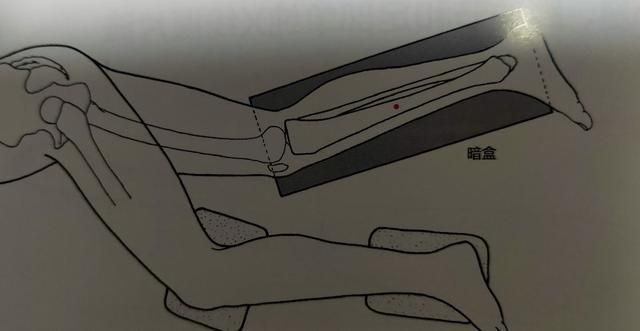 胫骨骨在哪里(胫骨远端在哪里)