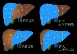 肝脏在哪个位置示意图(肝脏疼痛在哪个位置示意图)