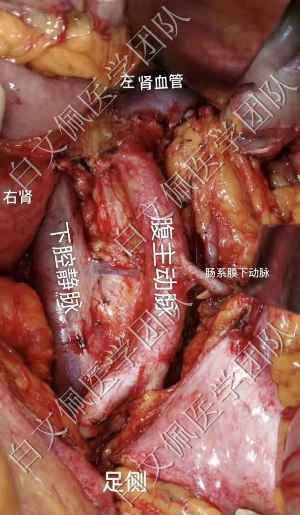 盆腔在哪个位置图解(盆腔在哪个位置图片)
