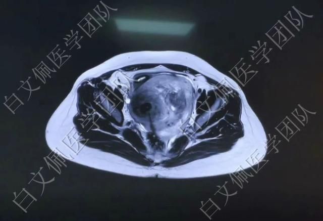 盆腔在哪个位置图解(盆腔在哪个位置图片)