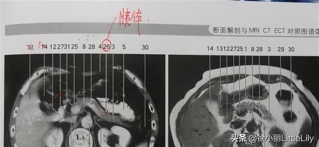 颞颥在哪(颞颥在哪个部位)