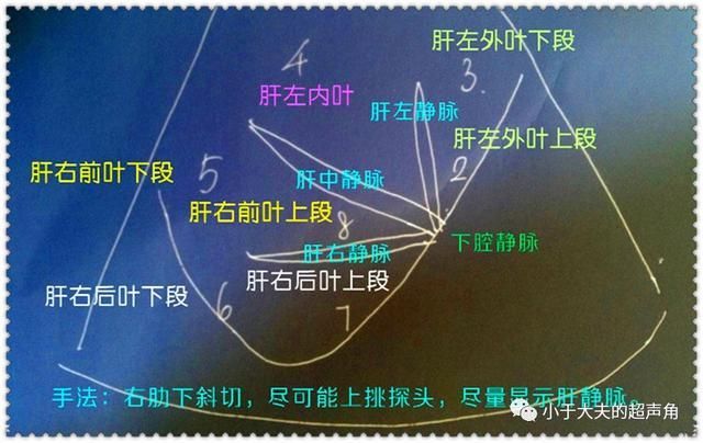肝右后叶在哪(肝右后叶钙化灶是什么意思)