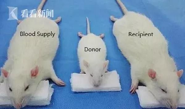 换头手术在哪里进行(换头手术在哪里做的)
