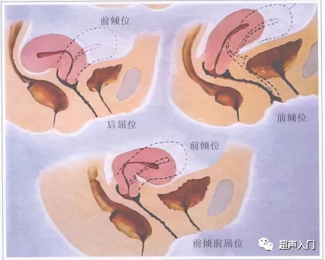子宫部位在哪里(子宫部位图解)