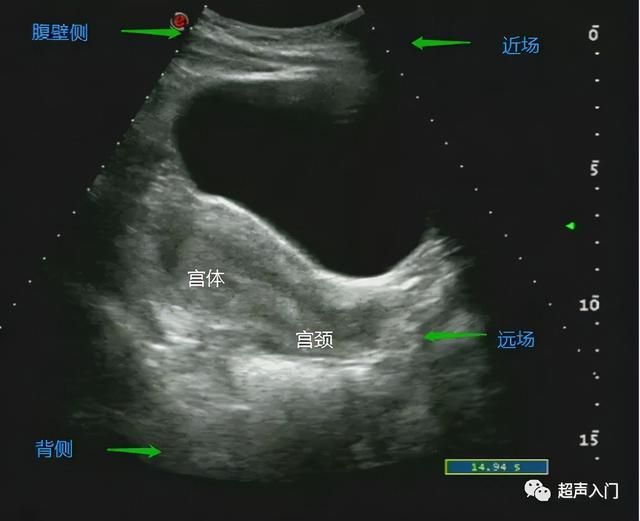 子宫部位在哪里(子宫部位图解)