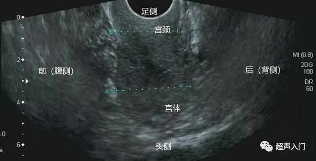 子宫部位在哪里(子宫部位图解)