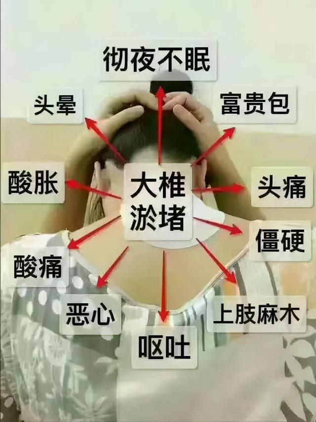 富贵包长在哪里(富贵包是如何形成的)