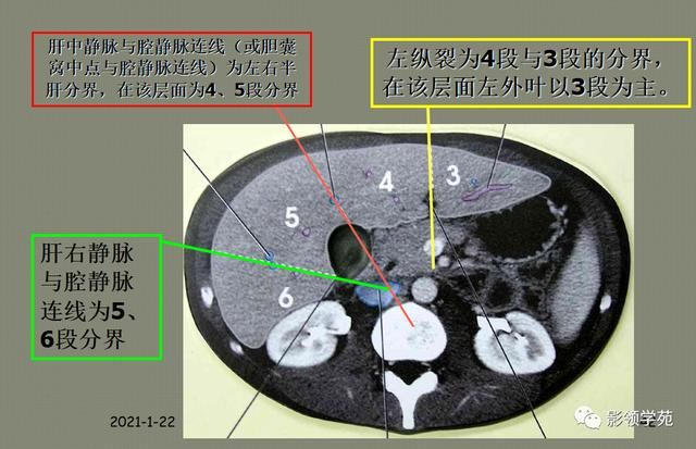 肝在哪里图片(肝在哪里位置图片)