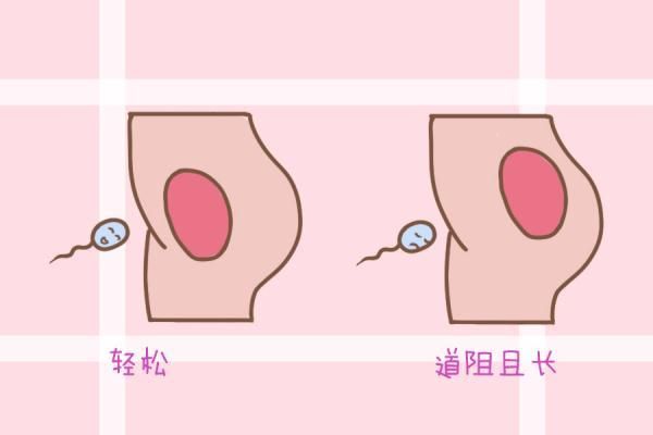 关于子宫右前壁在哪个位置的信息