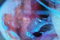 下鼻甲在哪个位置(双侧下鼻甲在哪个位置)