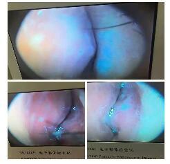 下鼻甲在哪个位置(双侧下鼻甲在哪个位置)